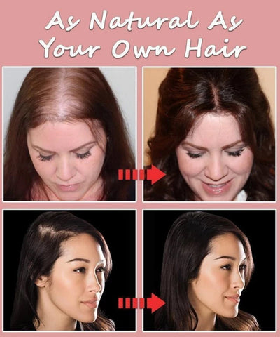 Seamless Silk-Base Hair Toppers【Buy 2 for free shipping】